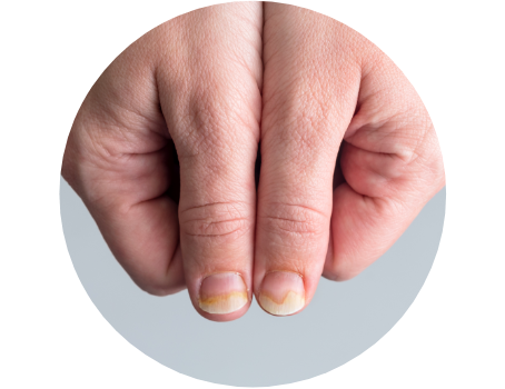 uñas
